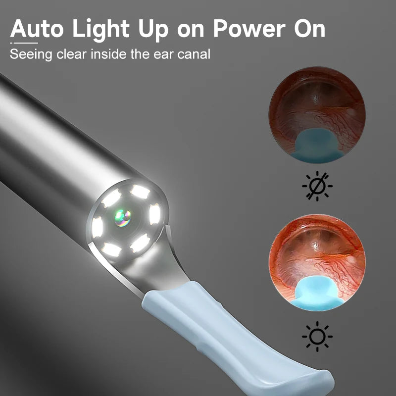 SmartEar Cleaner - 1080p HD - Wi-Fi Compatible - Safer than Cotton buds