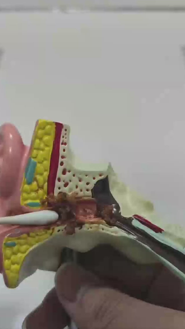 SmartEar Cleaner - 1080p HD - Wi-Fi Compatible - Safer than Cotton buds